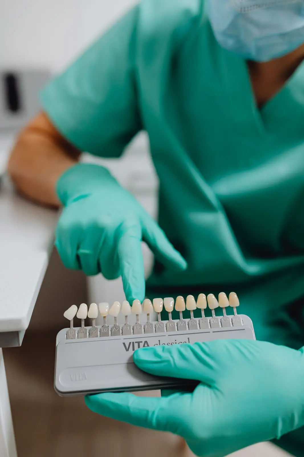 Profissional comparando tonalidades em um guia de cor dental