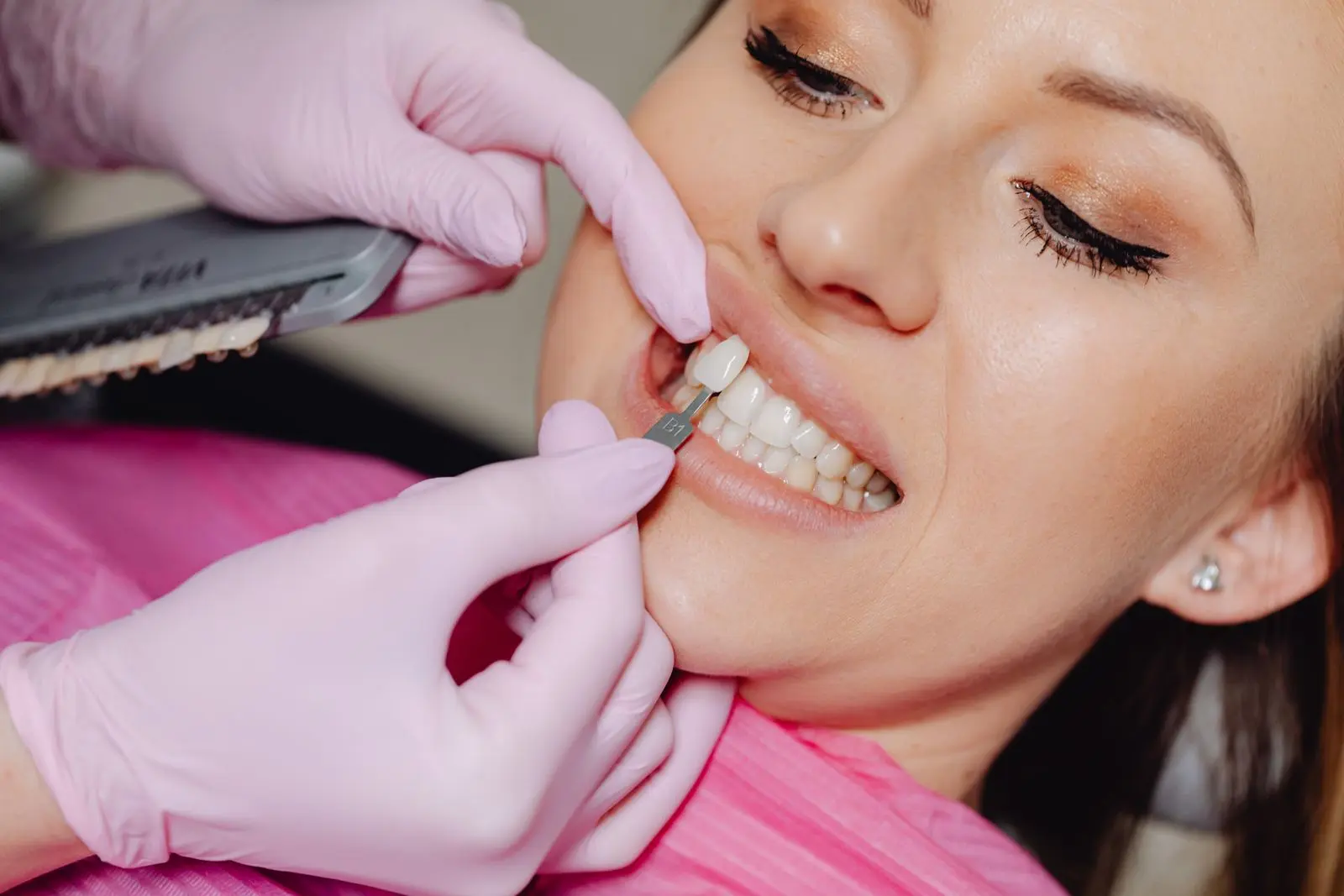 Profissional avaliando a tonalidade de um dente durante atendimento odontológico