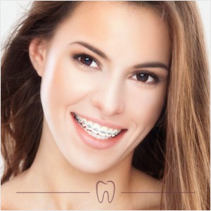 Aparelho Dental